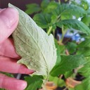 Edema