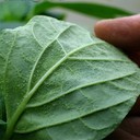 Edema